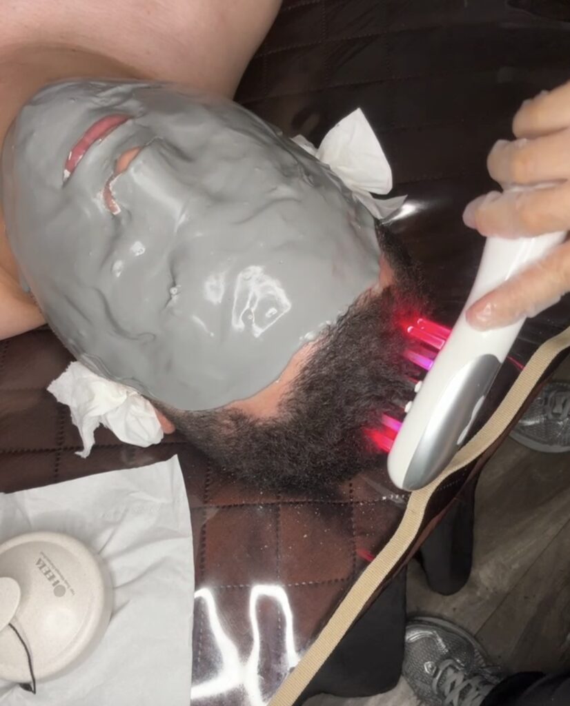 scalp treatment